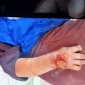 পাইকগাছায় বাকবিতন্ডায় জামাই শ্বাশুড়ি কামড়াকামড়ি