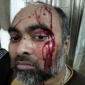চাঁদা না পেয়ে সহকারী মেডিকেল অফিসার মামুনের উপর হামলা; থানায় মামলা