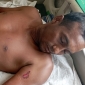 পাঁচশত টাকার জন্য ঘের মালিককে পিটিয়ে রক্তাক্ত জখম করলেন জমির মালিক