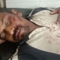 পাইকগাছার রাড়ুলীতে প্রতিপক্ষের হামলা ও মারপিটে আহত-১০