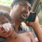 পাইকগাছায় ক্লাসরুমে ফ্যান খুলে পড়ে শিশুশিক্ষার্থী আহত