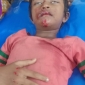 পাইকগাছায় মোটর সাইকেলের ধাক্কায় শিশু শিক্ষার্থীর দাঁত ভেঙে জখম